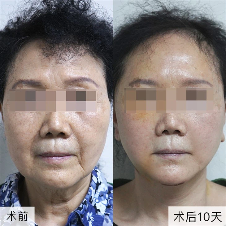 b1bc1ea14d0caad855fe293d003c7e6